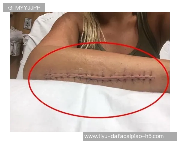 塔克遭遇伤病困扰初步诊断为硬伤赛后将进行详细检查以确定恢复情况 塔克遭遇伤病困扰初步诊断为硬伤赛后将进行详细检查以确定恢复情况